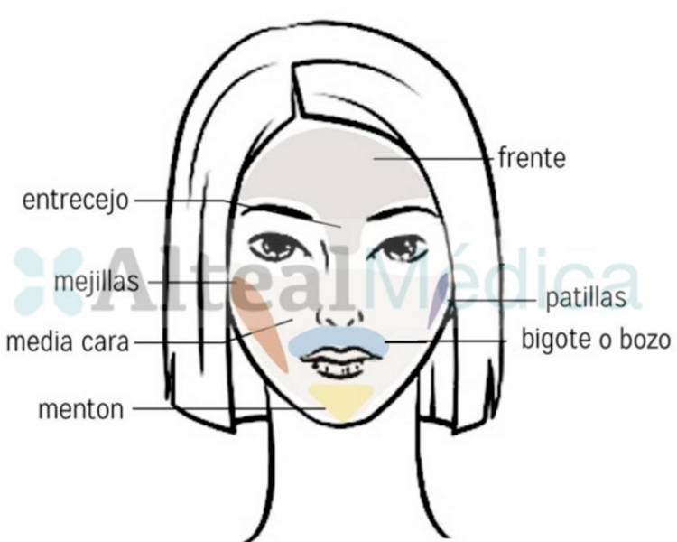 MENTÓN (1 sesión) Depilación Láser Diodo