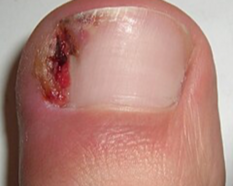 Pedicure