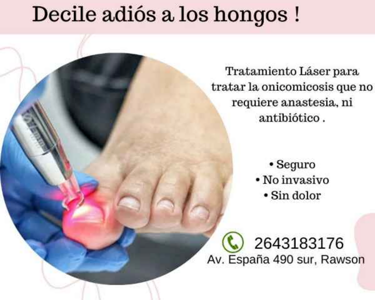 TRATAMIENTO PARA ONICOMICOSIS