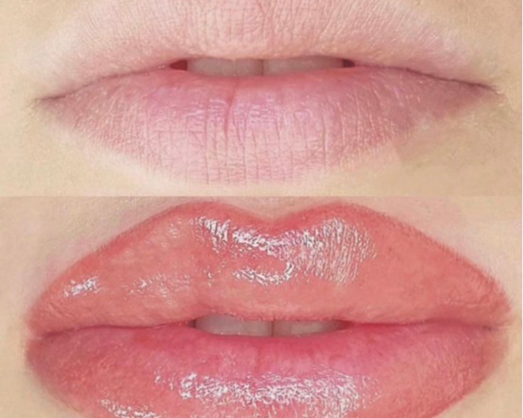 Acuarela Lips (micropigmentación de Labios efecto acuarela)