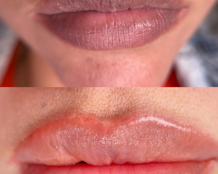 Neutralización Labial