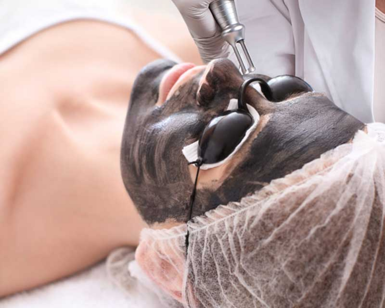 Láser Holliwood Peel