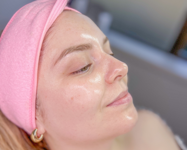 Skin Glass con Carboxy terapia
