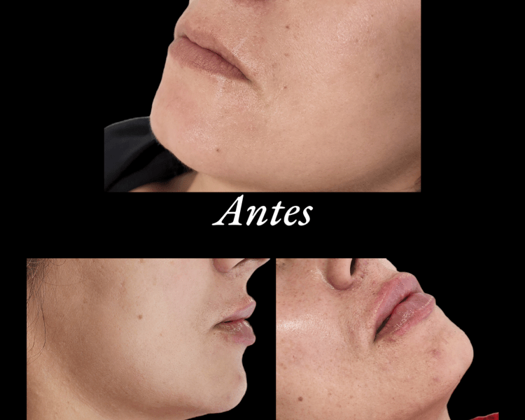 Armonización de labios