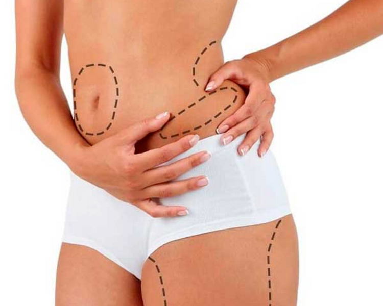 Liposonix 2X1