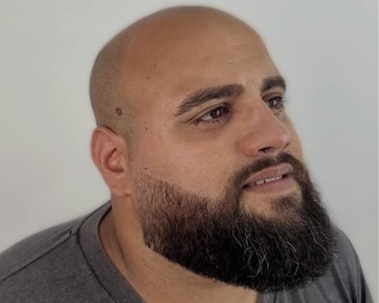 Arreglo de barba
