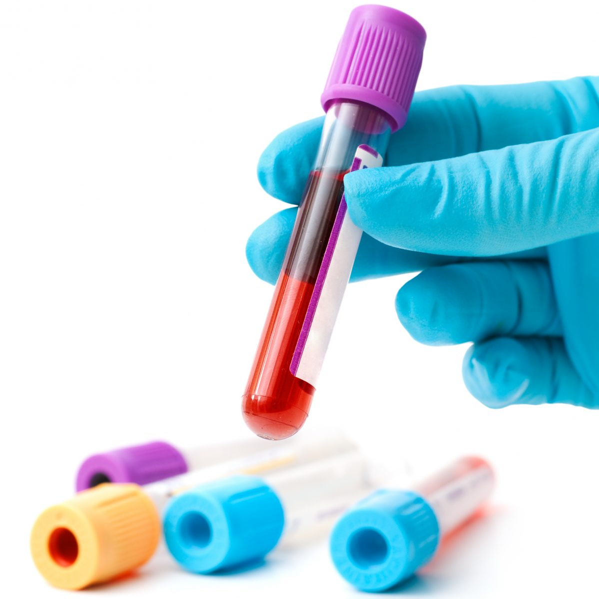 Examenes de Laboratorio