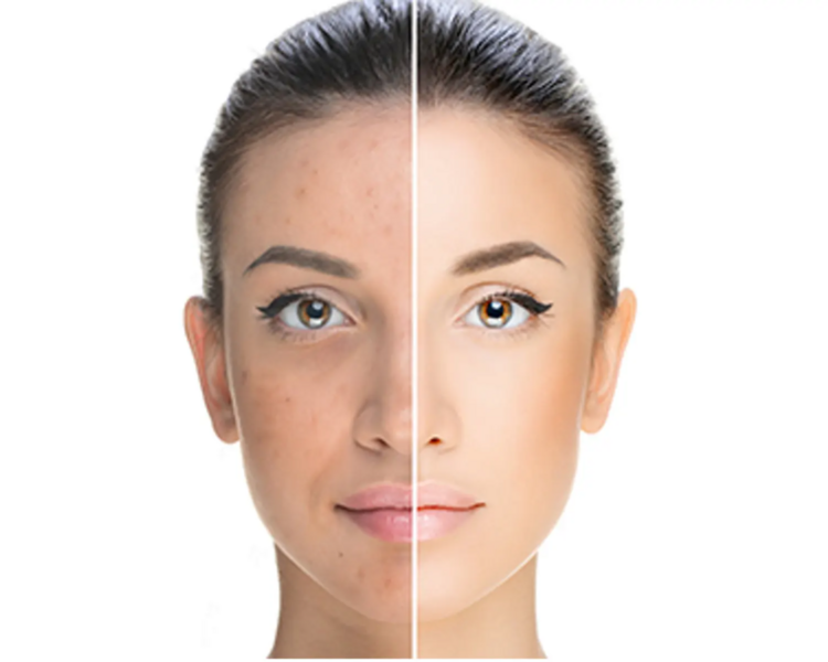 Protocolo ADN de Salmón Polibiorevitalizante