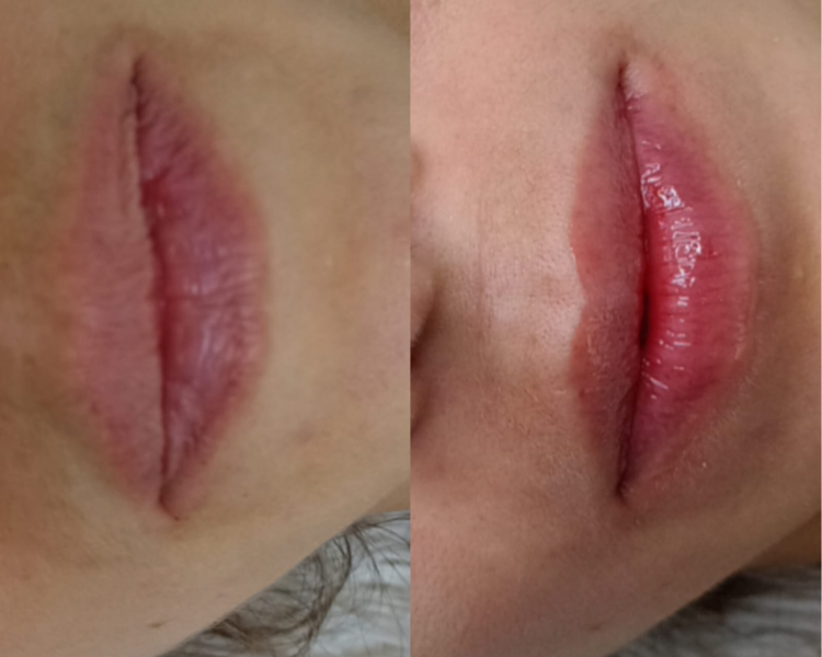 Hydragloss Lips