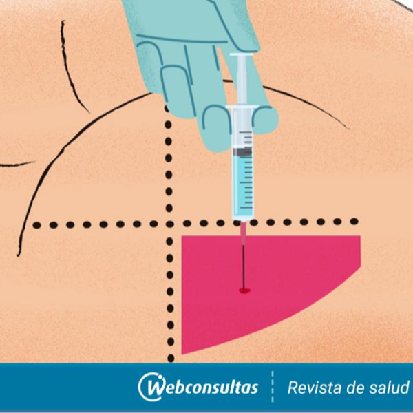 Inyección Intramuscular