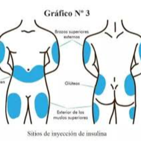 Inyección Subcutánea