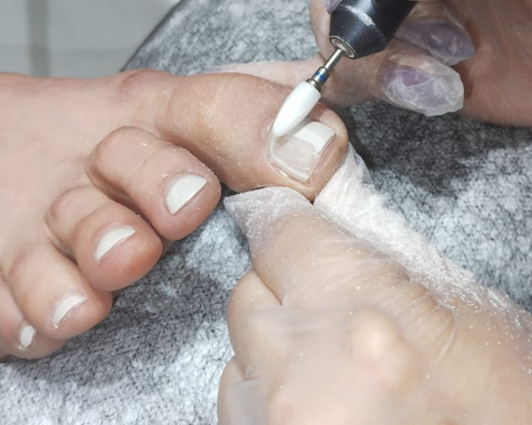 PEDICURE PERMANENTE CON RETIRO