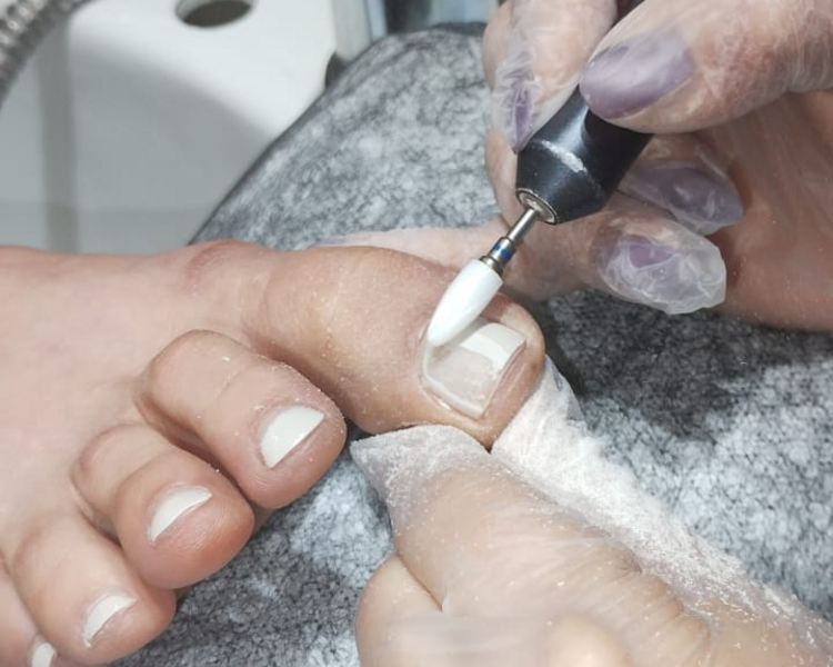 SOLO RETIRO PERMANENTE DE PEDICURE