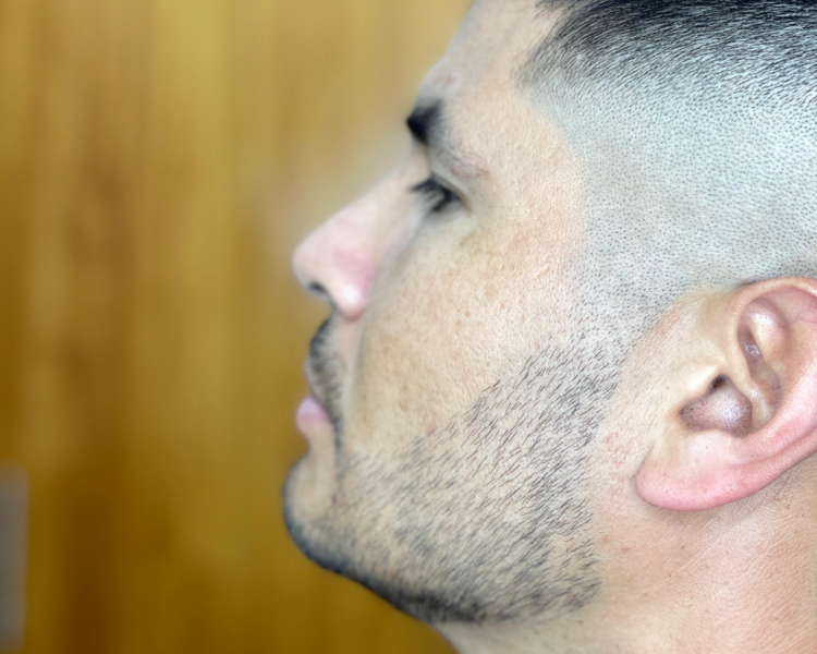 Perfilado de barba