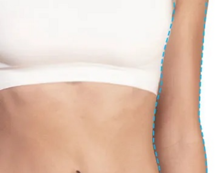 Brazos completos FEM