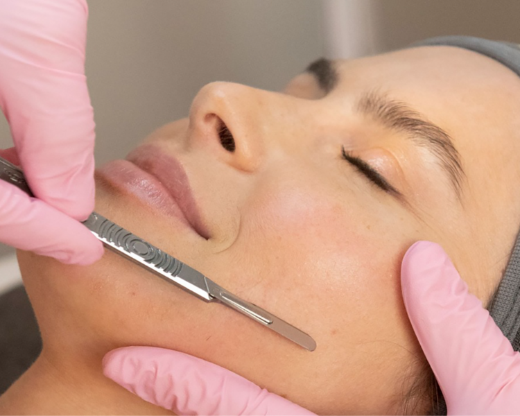 Dermaplaning