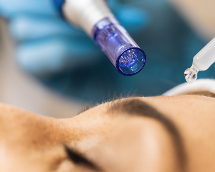 Dermapen 