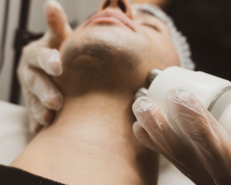 tripollar facial (radiofrecuencia pollogen )