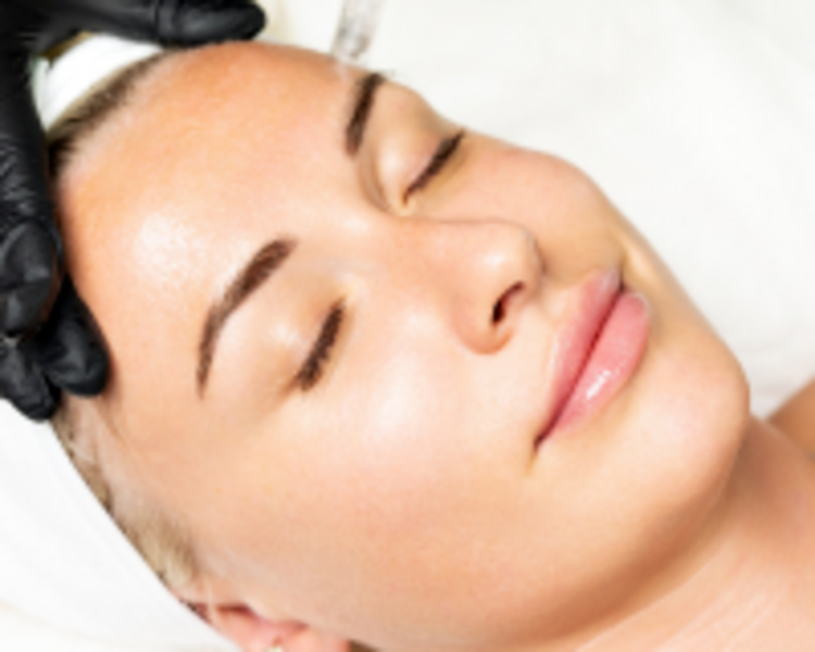 Microneedling/ Dermapen (tratamiento avanzado & correctivo) 