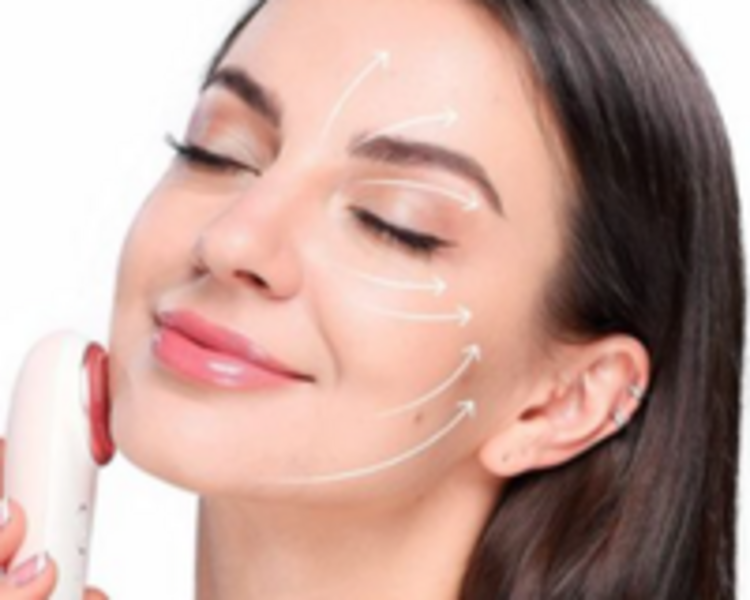 PUNTOS DE SUSTENTACION LIFTING FACIAL