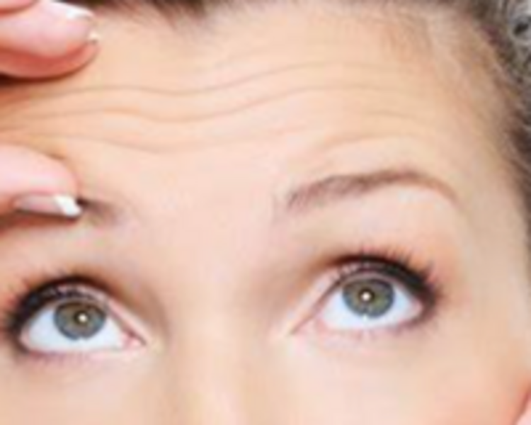 REGION GLABLELAR (ENTRECEJO) -DESDE