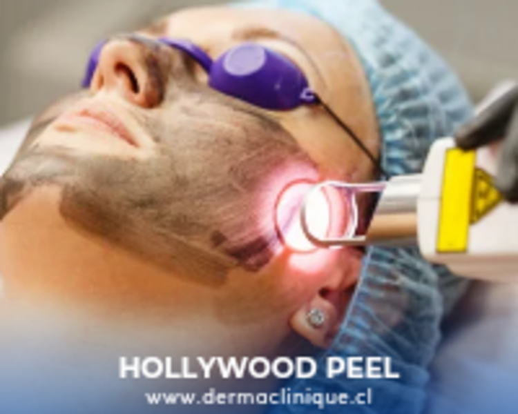 HOLLYWOOD PEEL