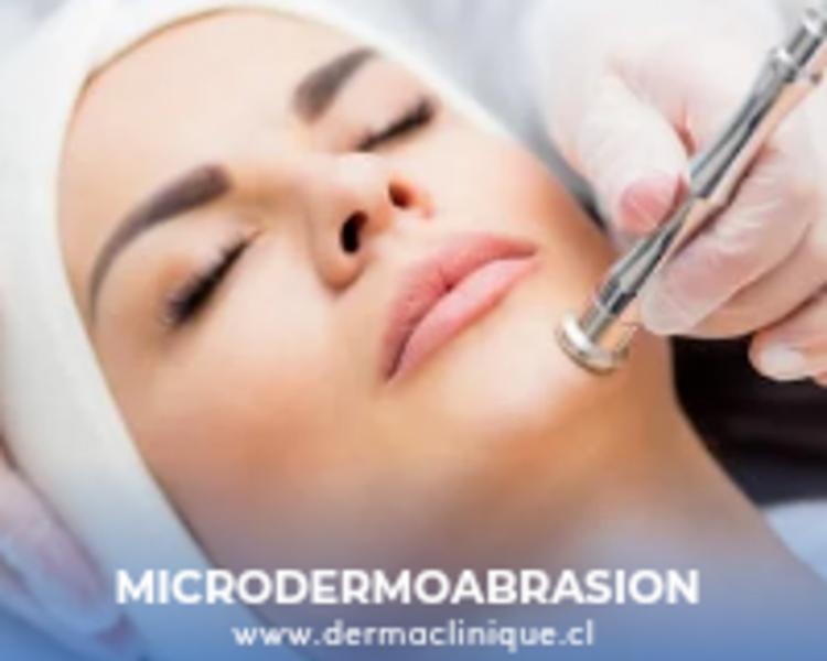 MICRODERMOABRASION FACIAL