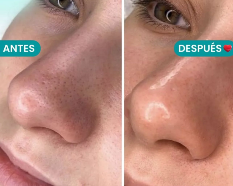 Limpieza facial básica