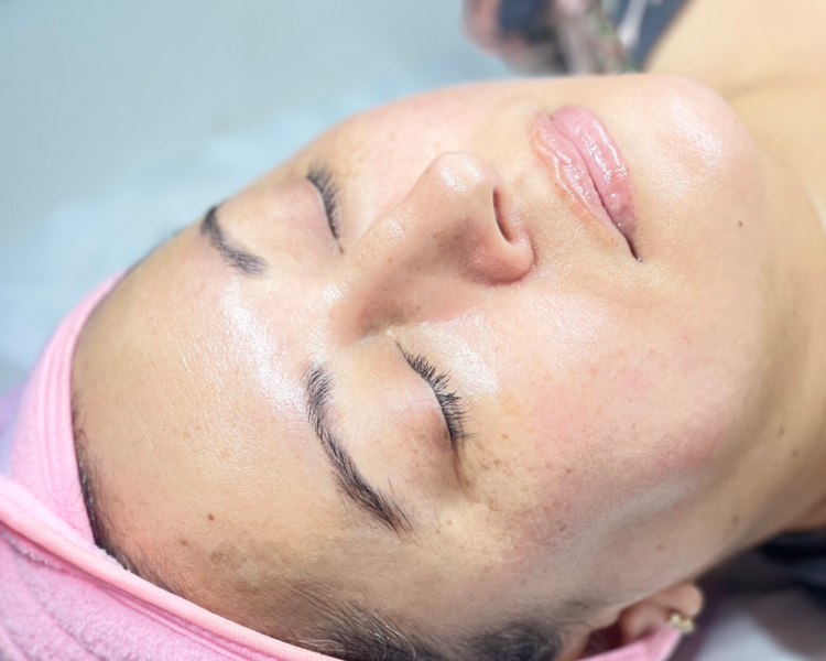 Pack carboxiterapia