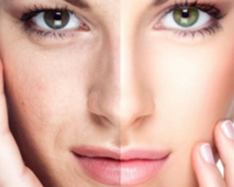 PLASMA + LIMPIEZA ESPECIALIZADA 