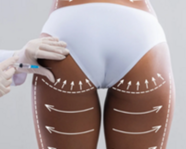 VITAMINA TAMPONADA -DESDE