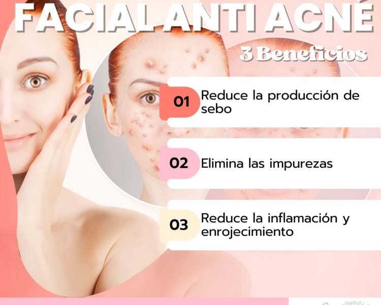 Antiacné IPL/ E-light PAQ 3 sesiones