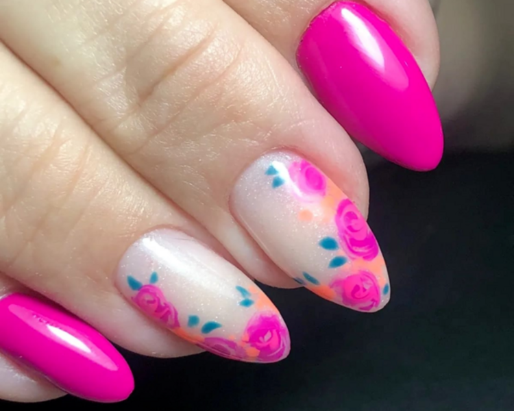 Refuerzo de semipermanente