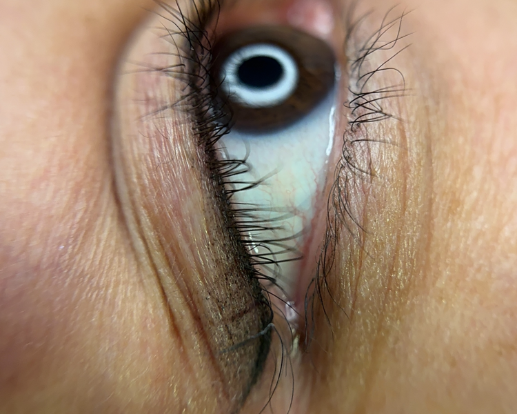 Sweet Liner (delineado de ojos) procedimiento diseñado para embellecer y definir los ojos 