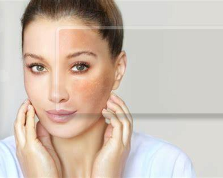 PAQUETE DESPIFMENTANTE 