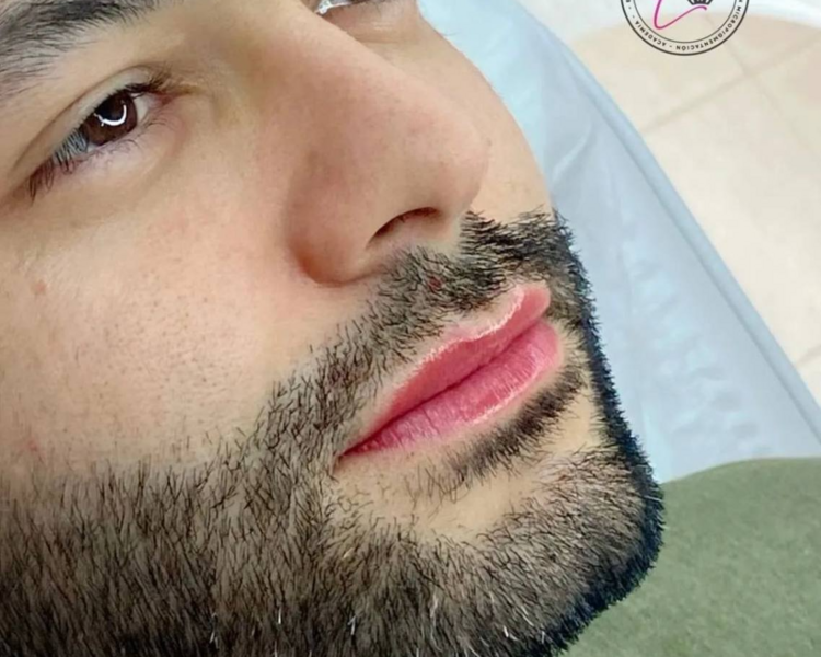 Revitalizacion Labial Masculino
