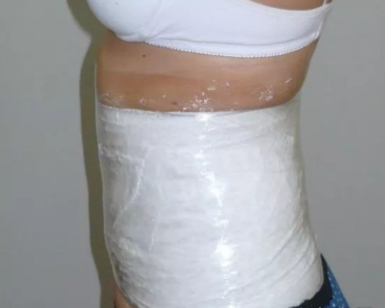 YESOTERAPIA