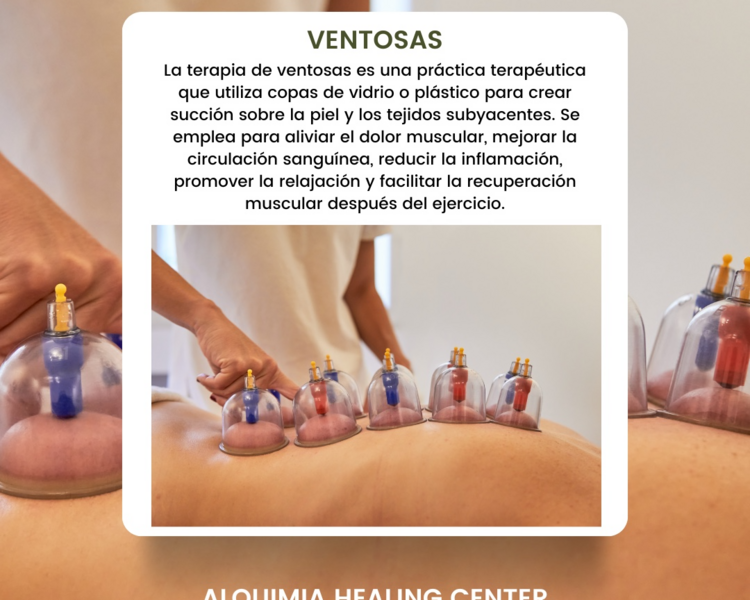 Terapia con Ventosas