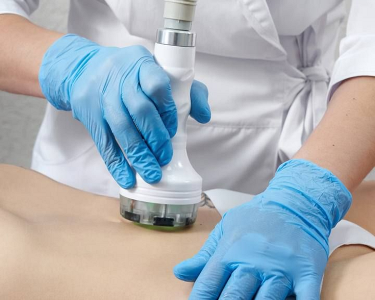 sesión individual lipoescultura sin cirugia intensivo
