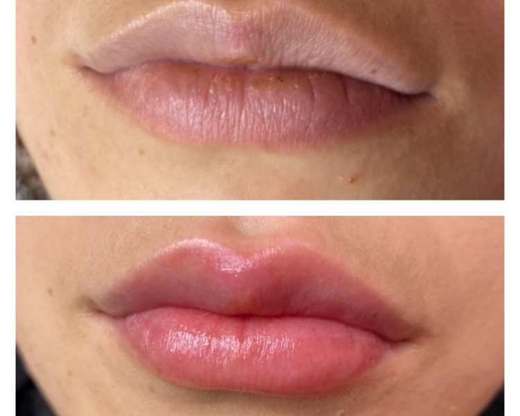glow lips labios (color + hidratación )