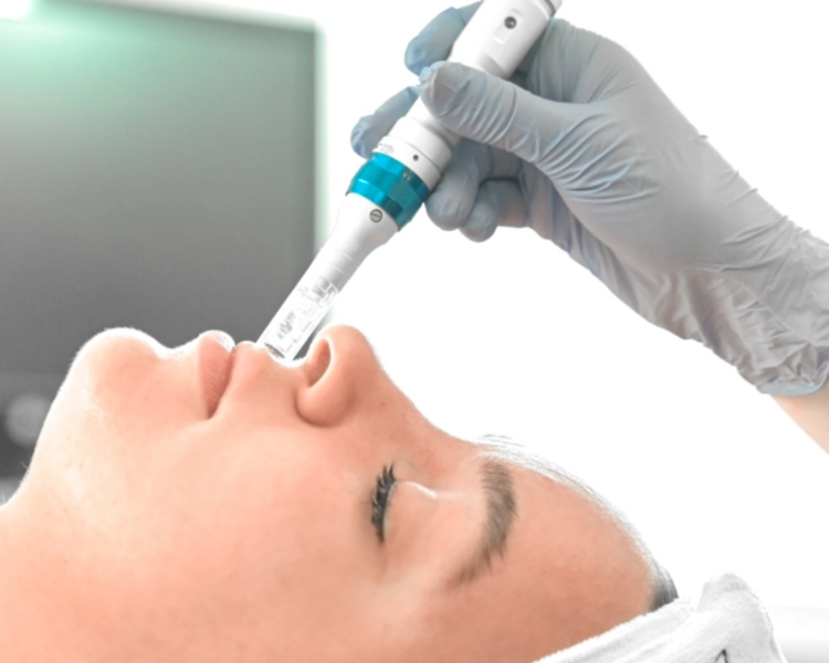 Dermaplaning + Dermapen con Exosomas (Importados de Corea)