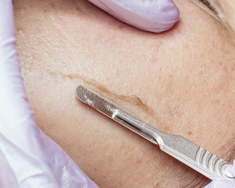 limpieza facial  premium