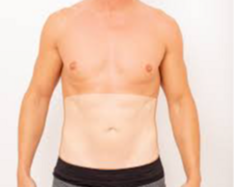 Abdomen 