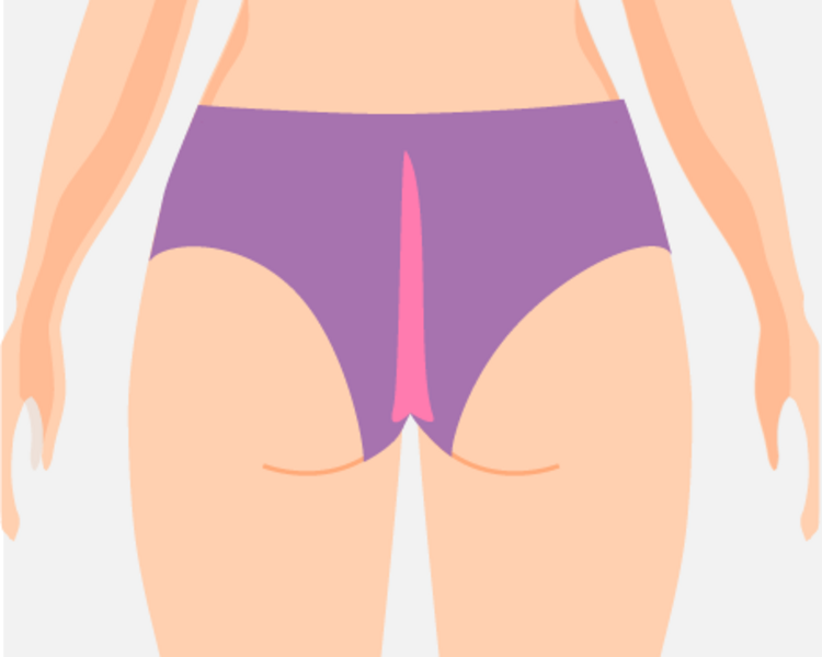 2x1 Cavado bikini + Tira de Cola