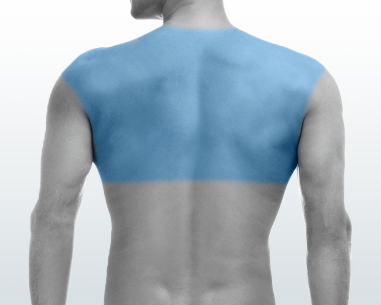 2x1 Media espalda + una zona menor