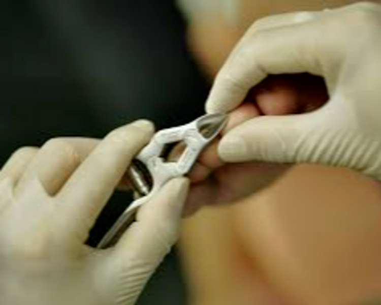 Corte de uñas