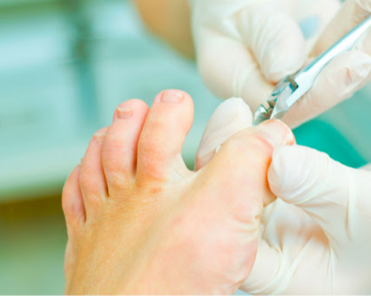 Corte de uñas