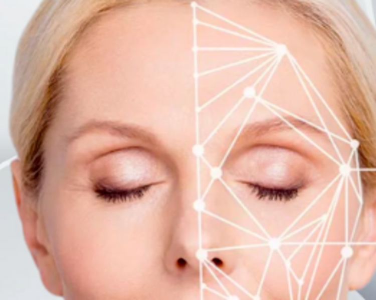 BOTOX FULL FACE