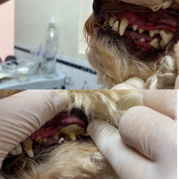 Profilaxis dental sin anestesia