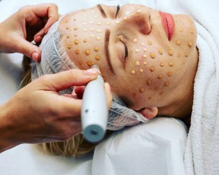 BBGlow PAQUETE 3 SESIONES